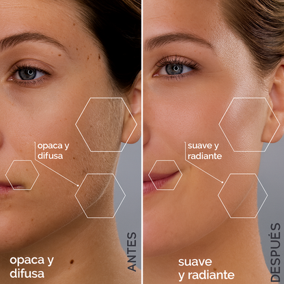 Dermaplaning Pro | Piel Nueva